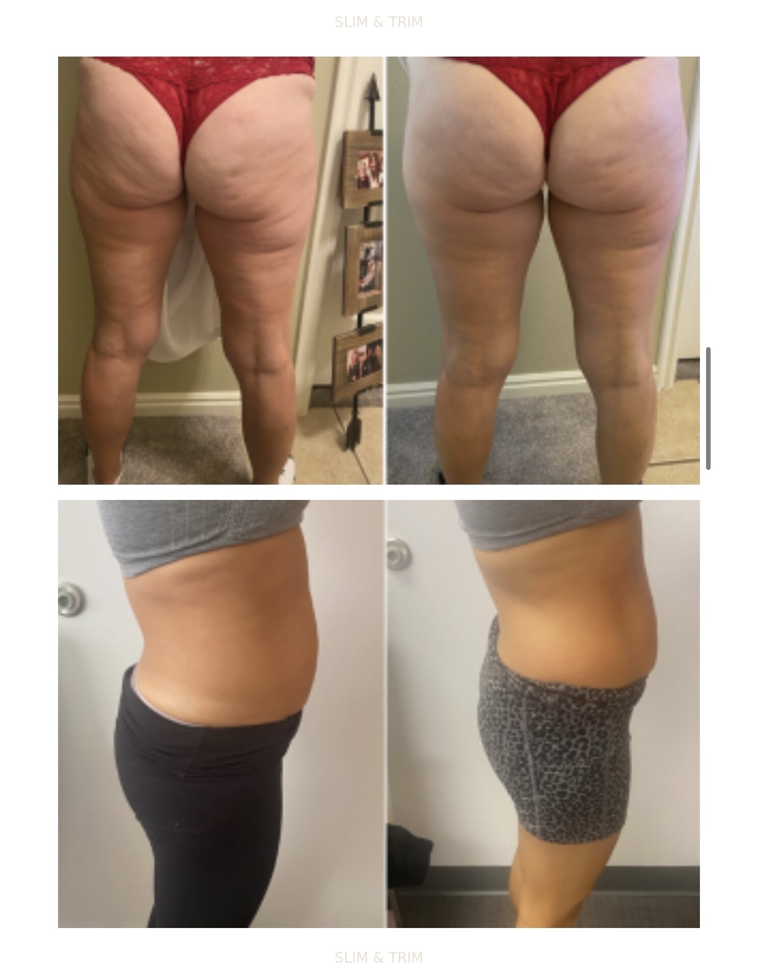 Client-provided before-and-after photo collage showing lower-body and waist views